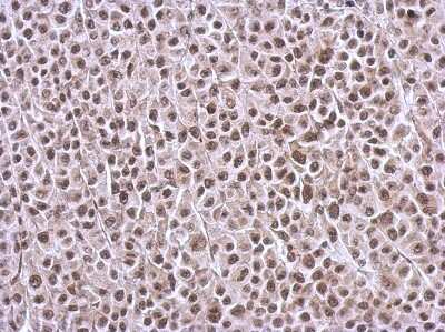 Immunohistochemistry-Paraffin: BRMS1L Antibody [NBP2-15619]