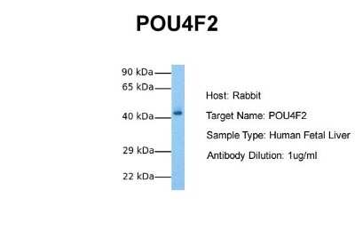 Western Blot: BRN3B/POU4F2 Antibody [NBP2-86585]