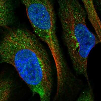 Immunocytochemistry/ Immunofluorescence: BROX Antibody [NBP1-90706]