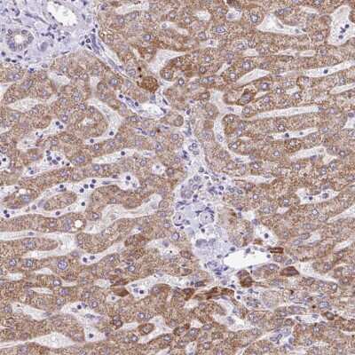 Immunohistochemistry-Paraffin: BRP44 Antibody [NBP2-31623]