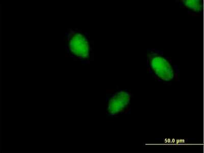 Immunocytochemistry/ Immunofluorescence: BRPF1 Antibody [H00007862-B01P]