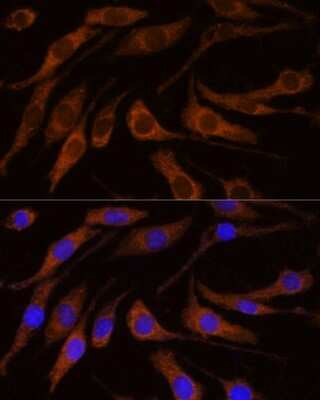 Immunocytochemistry/ Immunofluorescence: BRPF1 Antibody - Azide and BSA Free [NBP3-15510]