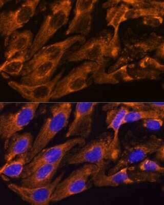 Immunocytochemistry/ Immunofluorescence: BRPF1 Antibody - Azide and BSA Free [NBP3-15510]