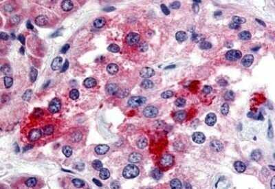 Immunohistochemistry-Paraffin: BRS3 Antibody - BSA Free [NB100-58984]