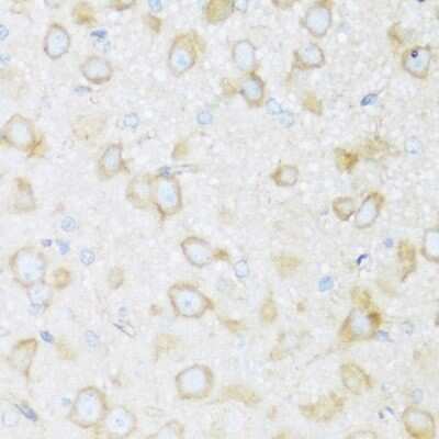 Immunohistochemistry-Paraffin: BRSK1 Antibody - Azide and BSA Free [NBP3-04952]