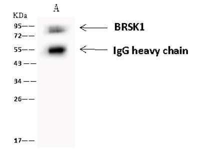 Immunoprecipitation: BRSK1 Antibody [NBP2-98618]