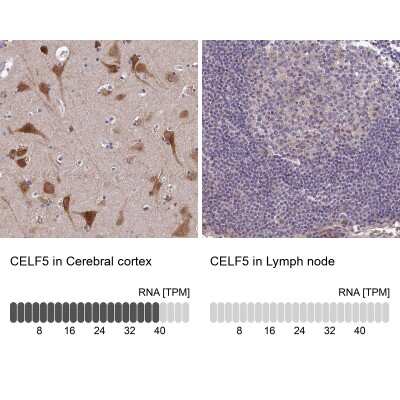 Immunohistochemistry-Paraffin: BRUNOL5 Antibody [NBP1-89931]