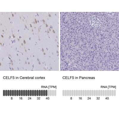 Immunohistochemistry-Paraffin: BRUNOL5 Antibody [NBP2-34134]
