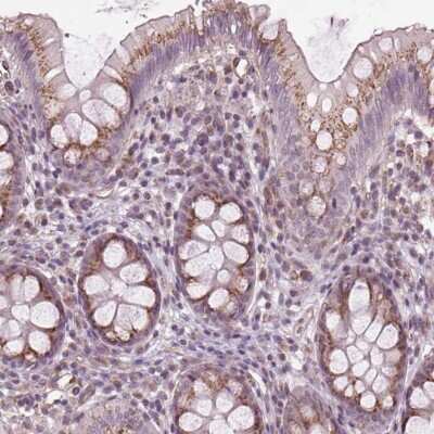 Immunohistochemistry: BSDC1 Antibody [NBP2-38180]