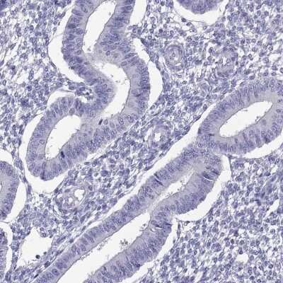Immunohistochemistry-Paraffin: BSPH1 Antibody [NBP2-62617]