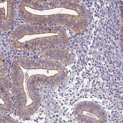 Immunohistochemistry-Paraffin: BSPRY Antibody [NBP1-82204]