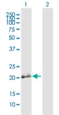 Western Blot: BSPRY Antibody [H00054836-B01P]