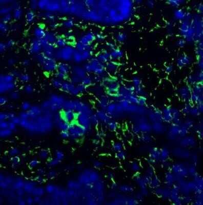 Immunohistochemistry: BST2 Antibody - Azide Free [NBP2-45265]