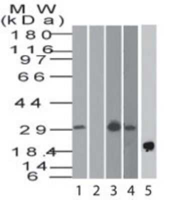 Western Blot: BST2 AntibodyAzide Free [NBP2-45265]