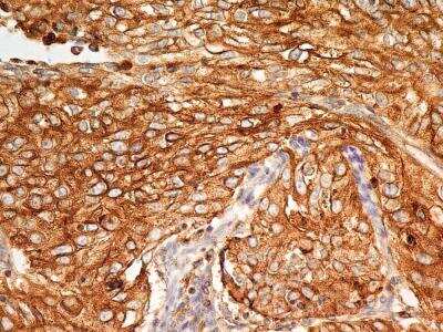 Immunohistochemistry-Paraffin: BST2 Antibody (2E2) - BSA Free [NBP2-29621]
