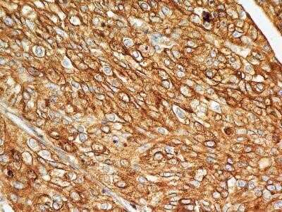 Immunohistochemistry: BST2 Antibody (4F6) - Azide and BSA Free [NBP2-80604]