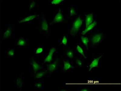 Immunocytochemistry/ Immunofluorescence: BST2 Antibody [H00000684-B02P]