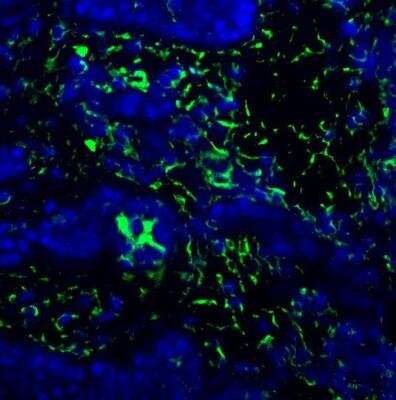 Immunohistochemistry-Frozen: BST2 Antibody [NBP2-27154]