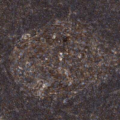 Immunohistochemistry-Paraffin: BST2 Antibody [NBP1-85760]