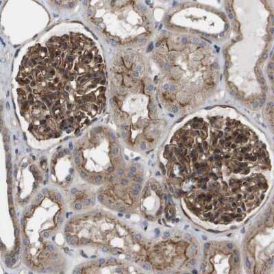 Immunohistochemistry-Paraffin: BST2 Antibody [NBP1-85760]