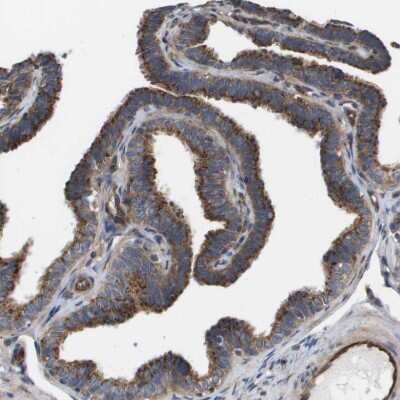 Immunohistochemistry-Paraffin: BST2 Antibody [NBP1-85760]