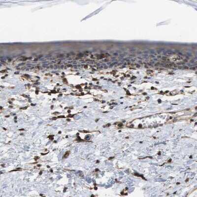 Immunohistochemistry-Paraffin: BST2 Antibody [NBP1-85760]
