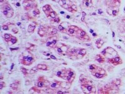 Immunohistochemistry-Paraffin: BST2 Antibody [NBP2-27154]