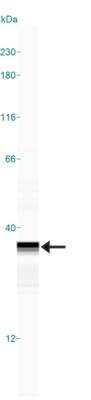 Simple Western: BST2 Antibody [NBP2-27154]