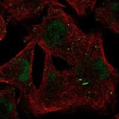 Immunocytochemistry/ Immunofluorescence: BTBD1 Antibody [NBP3-17690]