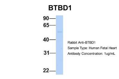 Western Blot: BTBD1 Antibody [NBP2-87087]