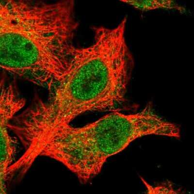 Immunocytochemistry/ Immunofluorescence: SLX4 Antibody [NBP2-58436]
