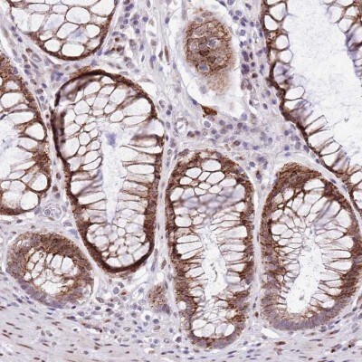 Immunohistochemistry: BTBD14A Antibody [NBP2-30579]