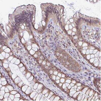 Immunohistochemistry: BTBD14A Antibody [NBP2-30655]