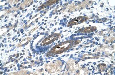 Immunohistochemistry: BTBD14A Antibody [NBP2-84518]