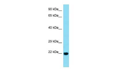 Western Blot: BTBD2 Antibody [NBP3-09217]