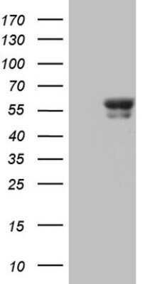 Western Blot: BTBD3 Antibody (OTI1A10)Azide and BSA Free [NBP2-71699]