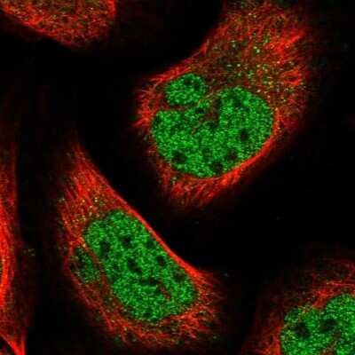 Immunocytochemistry/ Immunofluorescence: BTBD6 Antibody [NBP1-88672]