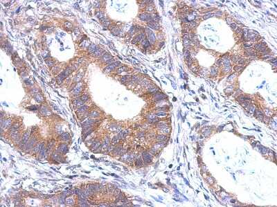 Immunohistochemistry-Paraffin: BTBD6 Antibody [NBP2-15627]