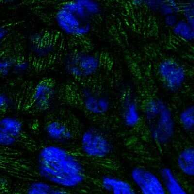 Immunocytochemistry/ Immunofluorescence: BTBD7 Antibody [NBP2-14364]
