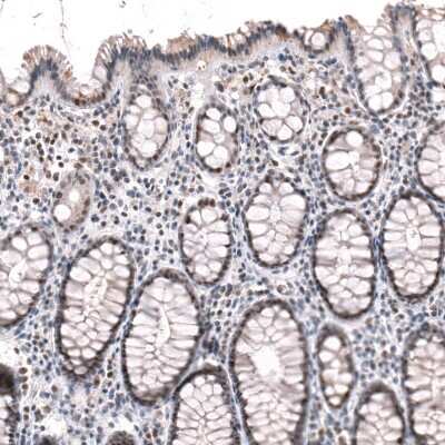 Immunohistochemistry-Paraffin: BTBD7 Antibody [NBP2-14364]