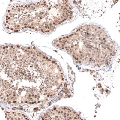 Immunohistochemistry-Paraffin: BTBD7 Antibody [NBP2-14364]