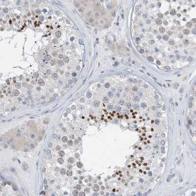 Immunohistochemistry-Paraffin: BTBD8 Antibody [NBP2-38246]