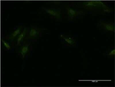 Immunocytochemistry/ Immunofluorescence: BTBD9 Antibody (1G3) [H00114781-M02]