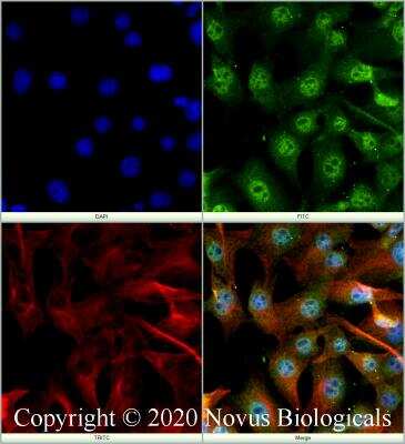 Immunocytochemistry/ Immunofluorescence: BTF Antibody [NBP2-24859]