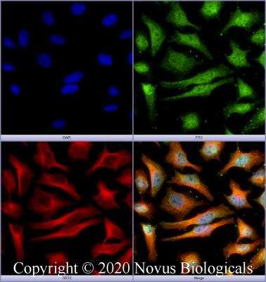 Immunocytochemistry/ Immunofluorescence: BTF Antibody [NBP2-24859]