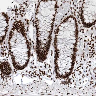 Immunohistochemistry-Paraffin: BTF Antibody [NBP1-89924]
