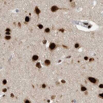 Immunohistochemistry-Paraffin: BTF Antibody [NBP1-89924]