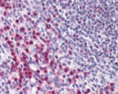 Immunohistochemistry-Paraffin: BTF Antibody [NBP2-24859]
