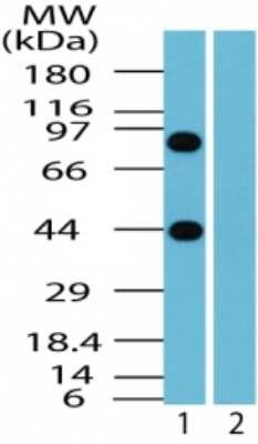 Western Blot: BTF Antibody [NBP2-24859]