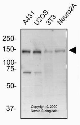 Western Blot: BTF Antibody [NBP2-24859]